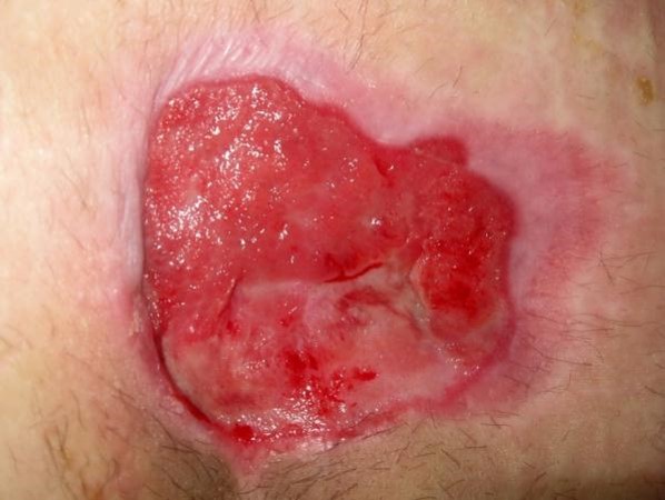 بافت گرانوله