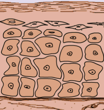 کراتینزیشن