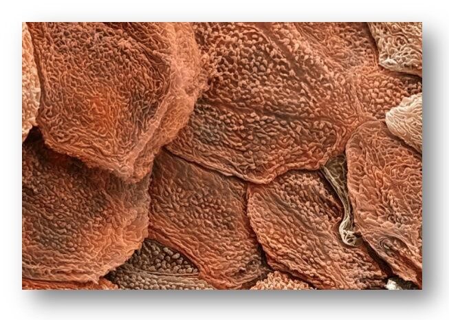 کراتینزیشن